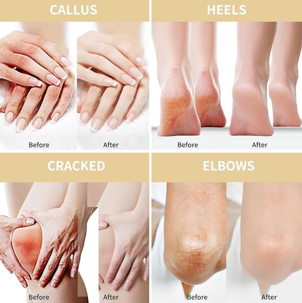 Crema Uree Reparatoare Intensă Picioare